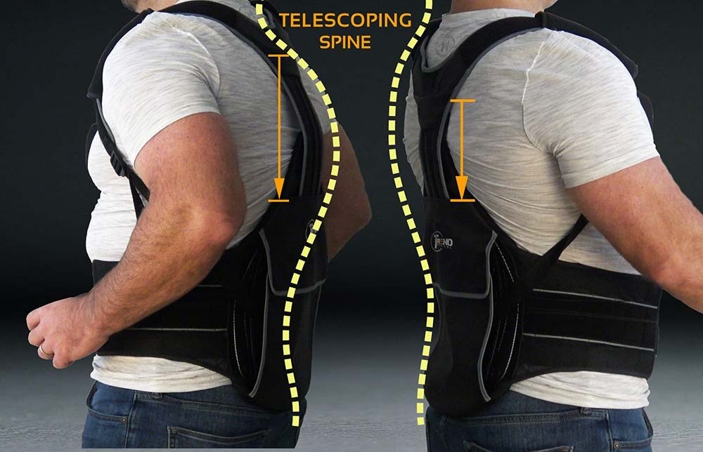 Two positions of the Trend Correx TLSO brace designed for comfort in New York