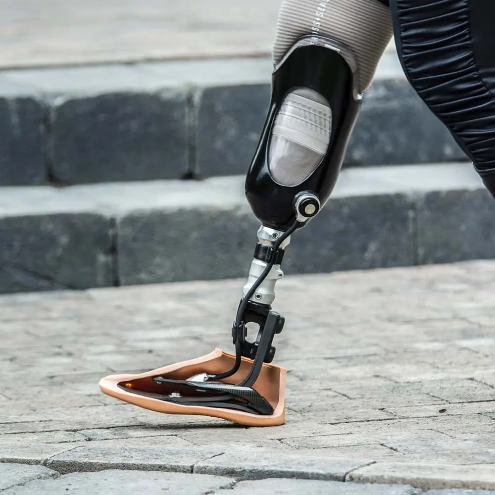 Iceross seal-in x locking silicone liner with prosthetic leg in New York, New Jersey, & Connecticut