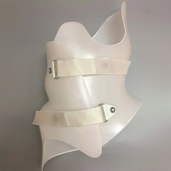 Boston Brace RC (Rigo-Cheneau) Scoliosis Brace