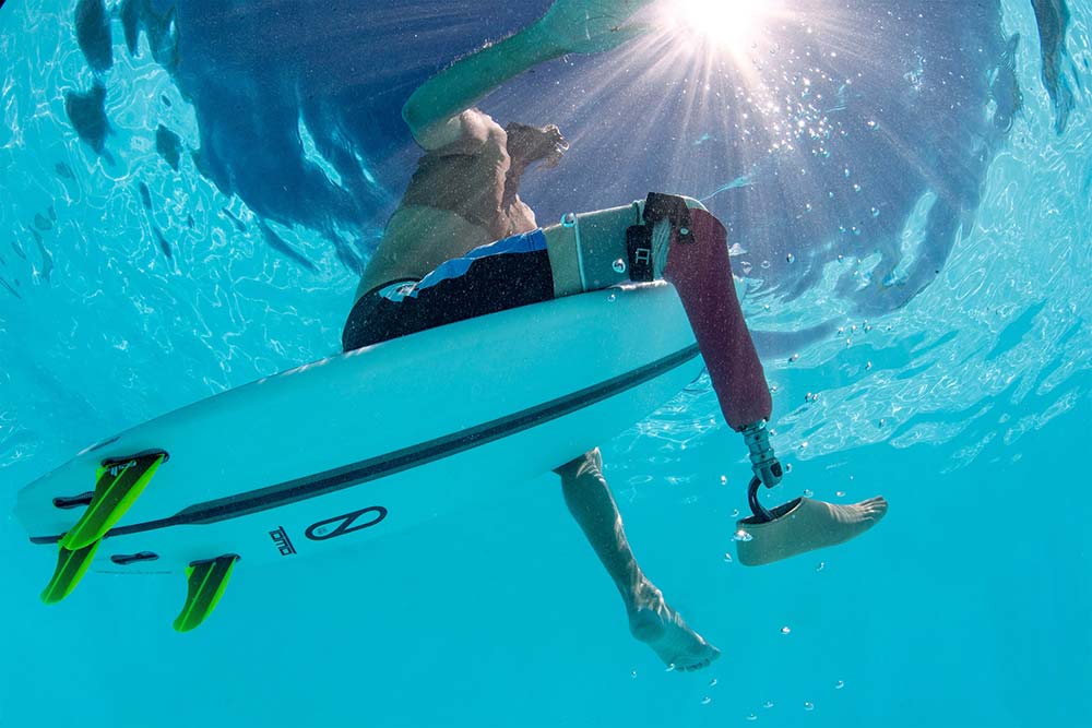 Pro-Flex XC Gallery Image