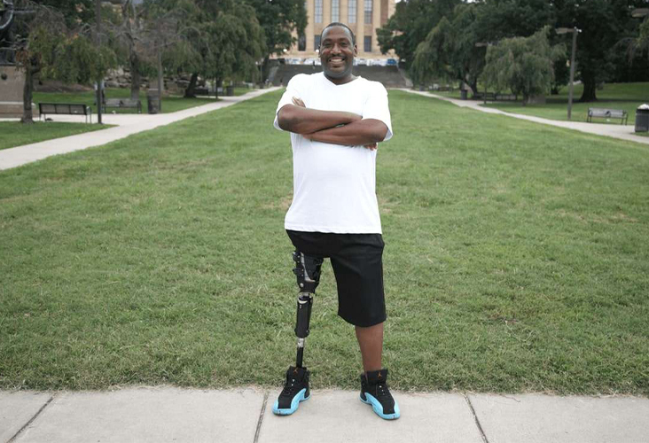 The iFIT Transfemoral socket