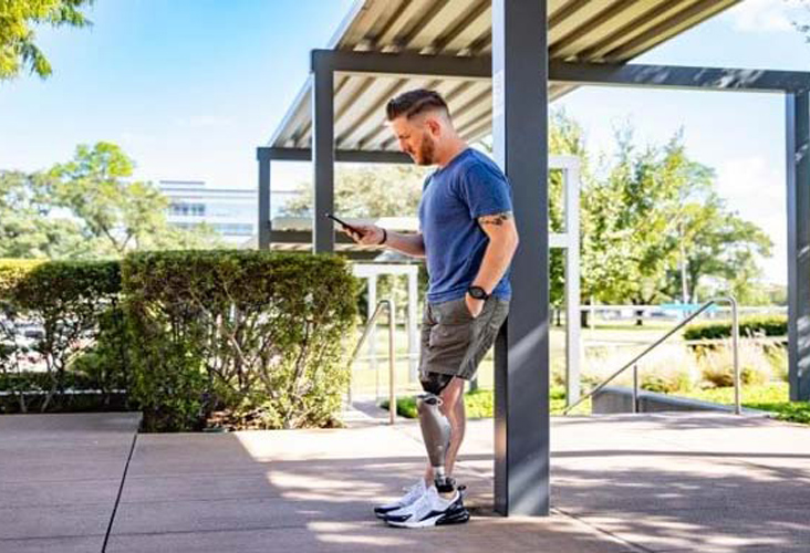 man with prosthetic leg leaning on a post