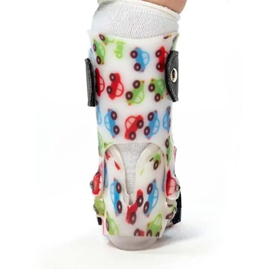 A child's foot in a Surestep SMO brace with an open heel modification, in New York